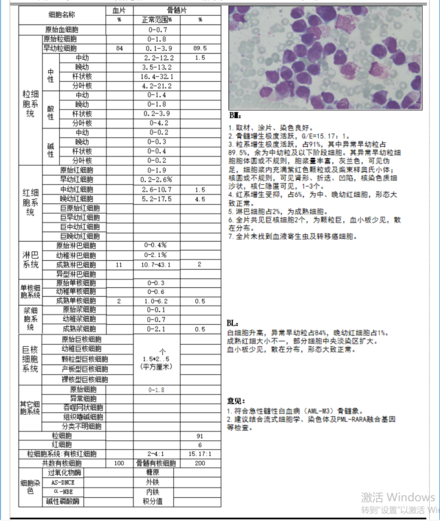 骨髓涂片 骨髓涂片