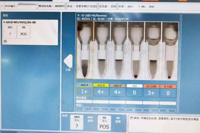 血型儀檢測結果