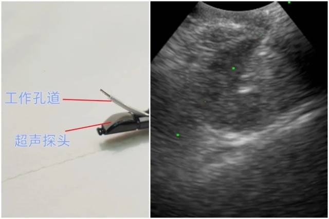 CP-EBUS，凸阵超声