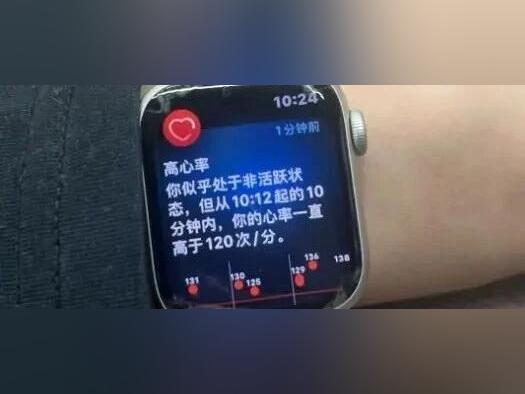 有一种焦虑叫“手表说我没睡好”