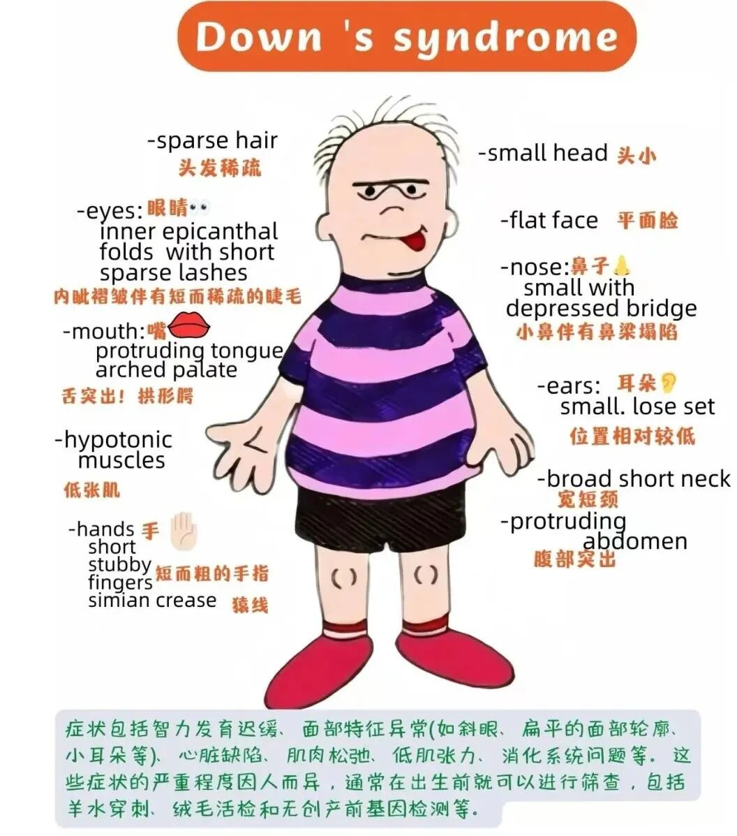 世界唐氏综合征日：共同对抗孤独，科学护航健康_南方+_南方plus