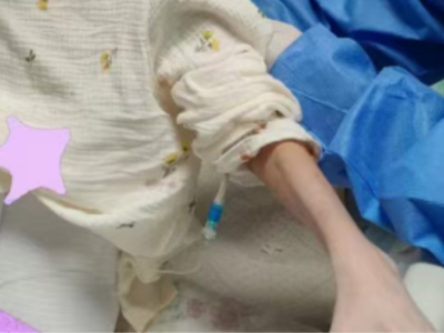 反复咳嗽、暴瘦20斤，她突发剧烈腹痛，陷入休克！这个“沉默杀手”很凶险→