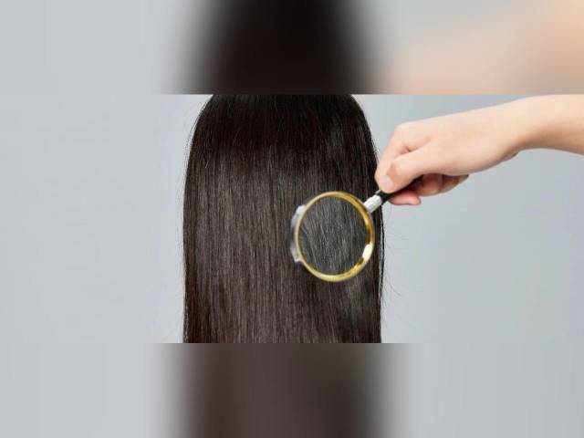 脱发、头发油腻、发际线后移......解决头发“疑难杂症”，试试这些方法