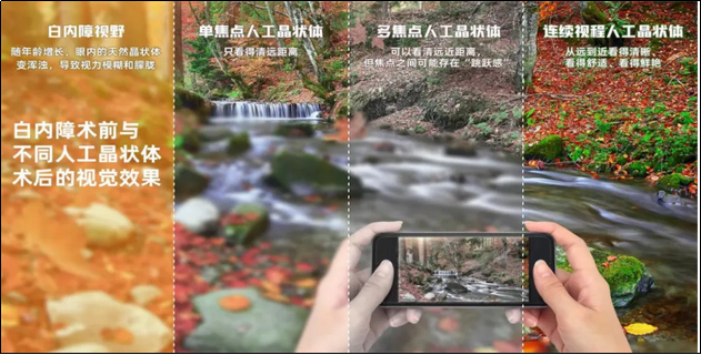 屈光性白内障手术,让视力回到年轻时代?