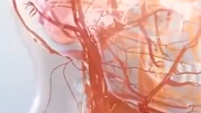 在+探科|在血管外科，如何判断血管生病了？