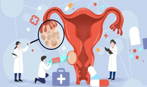 尧良清教授：如何打破卵巢癌治疗“魔咒”｜健康深一度