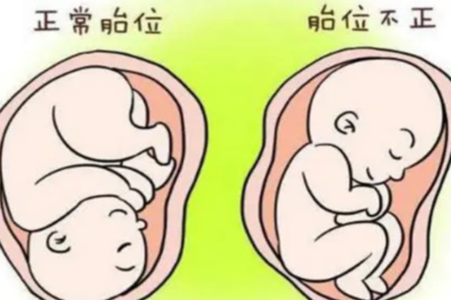 顺产还是剖宫产?听听助产士怎么说!