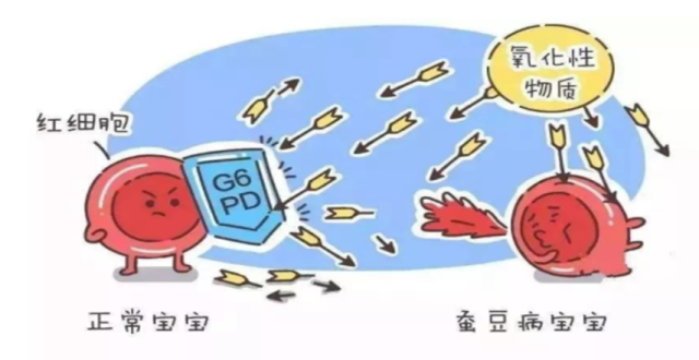 为什么医生总爱问“宝宝有没有蚕豆病?