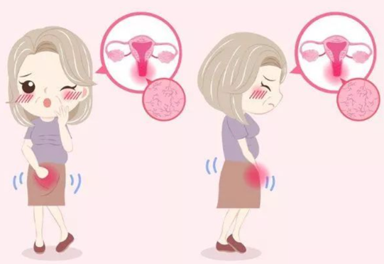 宫颈炎护理知识知多少