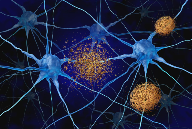 对于乳腺癌的靶向治疗,你了解多少?