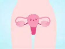 揪出子宫异常出血的“元凶”