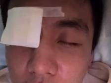 CBA球星眼睛受伤流血，结膜破碎“会瞎”吗？｜健康深一度