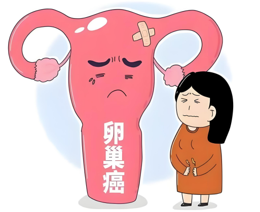 如何早期识别卵巢癌的隐秘症状?
