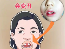 口呼吸，影响孩子颜值的