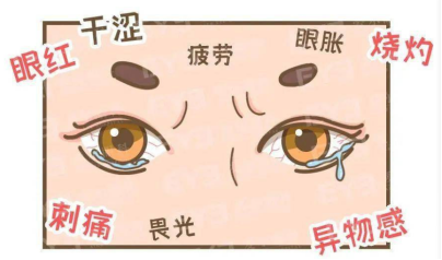 眼干发痒?警惕干眼小怪兽