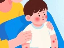 易传染、无疫苗！别让猩红热“盯上”孩子