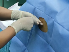 无痛分娩全揭秘：你想知道的都在这里