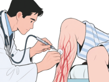 久坐党、高跟鞋控，你们的静脉在“抗议”了！