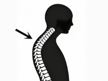 重视起来！脊柱后凸护理关键细节揭秘