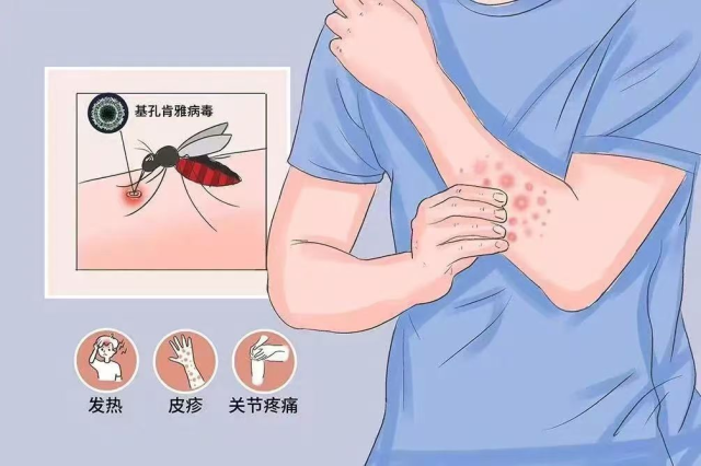 图片来源:深圳疾控 图片来源:深圳疾控