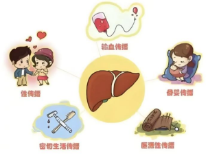 新药时代,丙肝治愈不再难