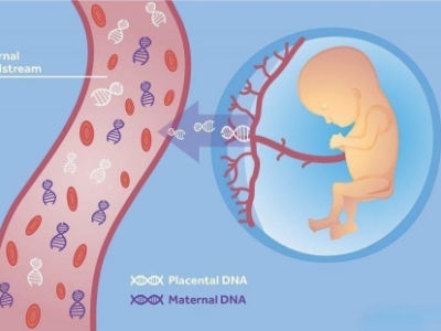 必看!哪些孕妇要做产前诊断?诊断些啥?