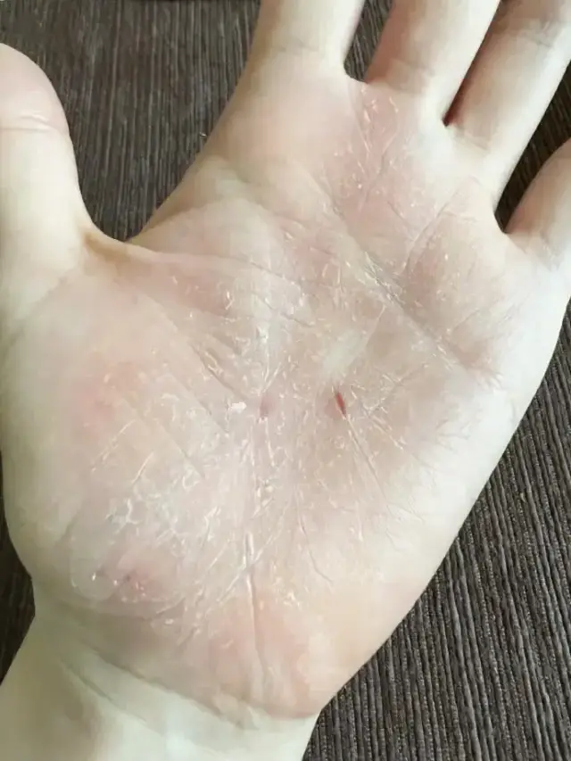 张靓颖手掌照片