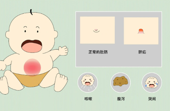 新生儿肚脐护理全攻略!脐带脱落期这样做才安心