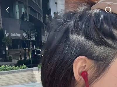 “白发针”火了，长了白发真能变黑？｜健康深一度