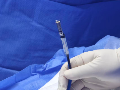 2克“心脏引擎”成功植入，暨大五院开启无导线起搏应用新篇章