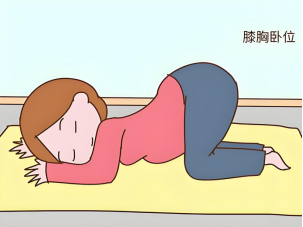 脐带脱垂:宝宝