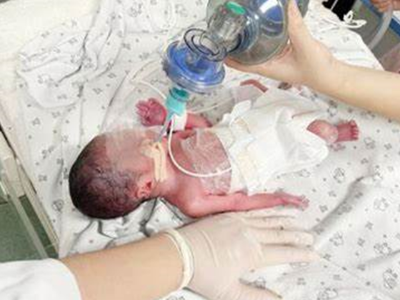 如何在NICU病房抢救一名呼吸窘迫综合征的早产儿