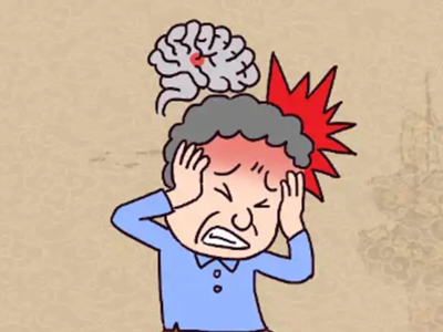 脑出血康复：大脑“服务器”崩溃后如何修复？