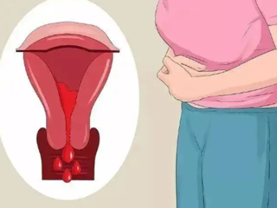 绝经后阴道出血别忽视，一文读懂应对方法