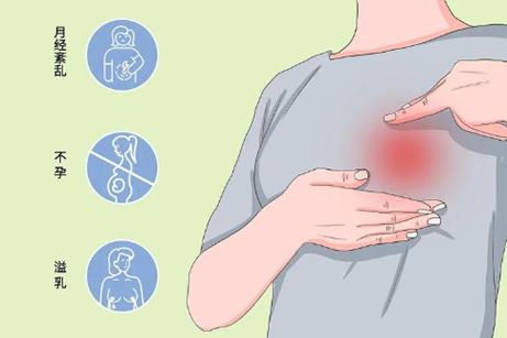 突然溢乳+月经失踪?警惕高泌乳素血症这个隐形杀手!