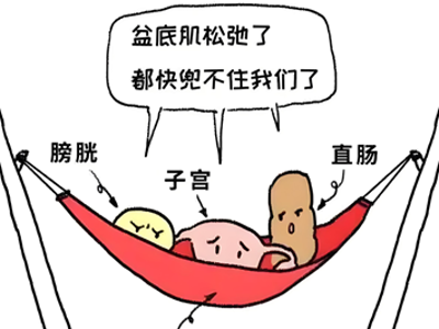 远离盆底肌疾病，这些生活习惯要养成