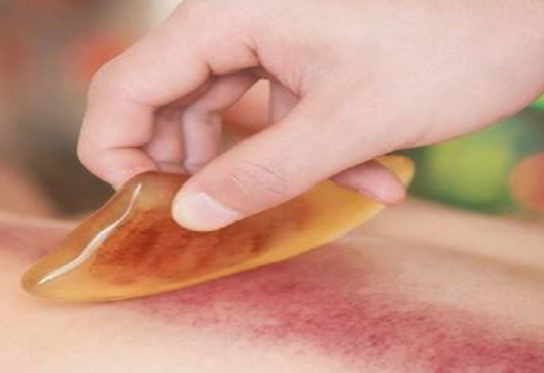 刮痧板是个宝,哪里不通往哪刮!