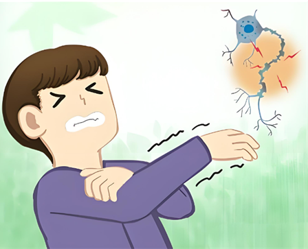 桡神经损伤莫惊慌,一文教你辨症状