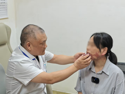 鲜红斑痣伴增生性血管瘤？  “口罩妈妈”有望摘口罩