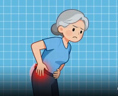 骨质疏松的5个隐匿症状 | 医视频