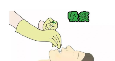 痰何容易——神经外科患者的吸痰通关攻略