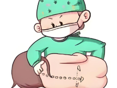 半麻后，我的腿去哪了？揭秘椎管内麻醉的奇妙体验