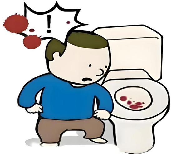 便便带血,是痔疮在“亮红灯”吗?