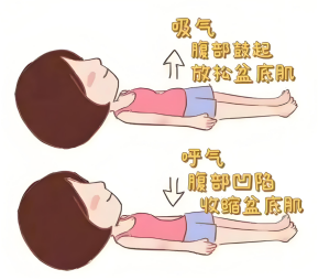 产后漏尿别慌!盆底肌康复护理小技巧