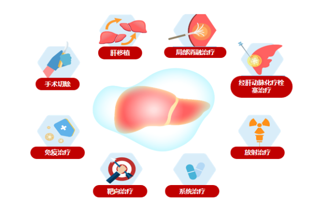 从“绝症”到可治之症 专家谈肝癌治疗新突破