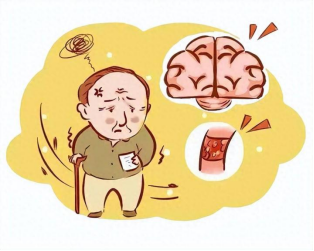 “时间就是生命”:卒中发作黄金4.5小时必争