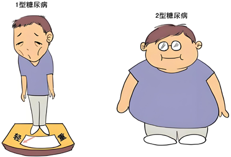 糖尿病不只是“血糖高”,详解1型、2型糖尿病的区别