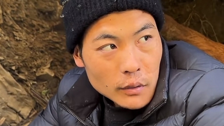 张家界荒野求生赛选手“刀疤哥”退赛续：或需住院观察数日南都即时14评