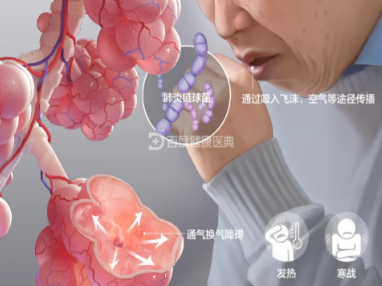 破局耐药困境,近20年首款全新类别抗菌药物进入国家医保