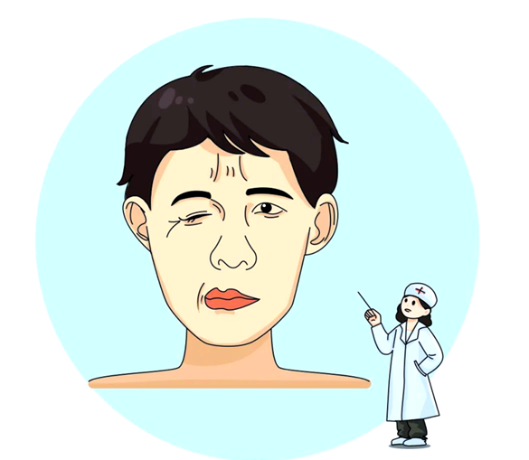 显微血管减压术:一场神经与血管的空间争夺战